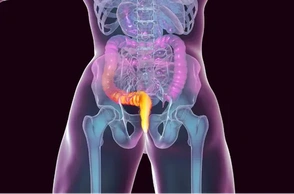 К чему снится геморрой