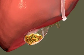 К чему снится желчь