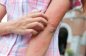 К чему снится, что покусали пчелы