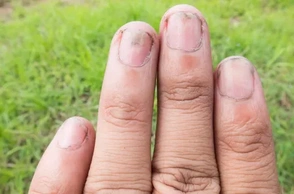 К чему снятся грязные ногти