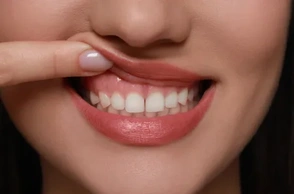 К чему снится десна